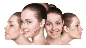 Dermal fillers injection procedure in Izmir dermatology clinic