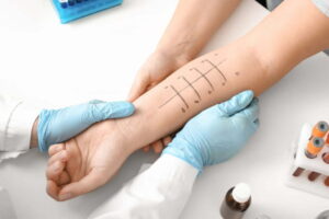 İzmir’de dermatolog tarafından uygulanan alerji tedavisi