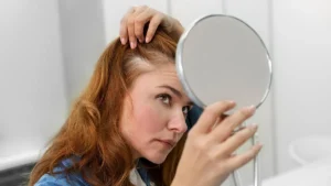 Kadınlarda Saç Dökülmesi Tedavileri – Dermatolog