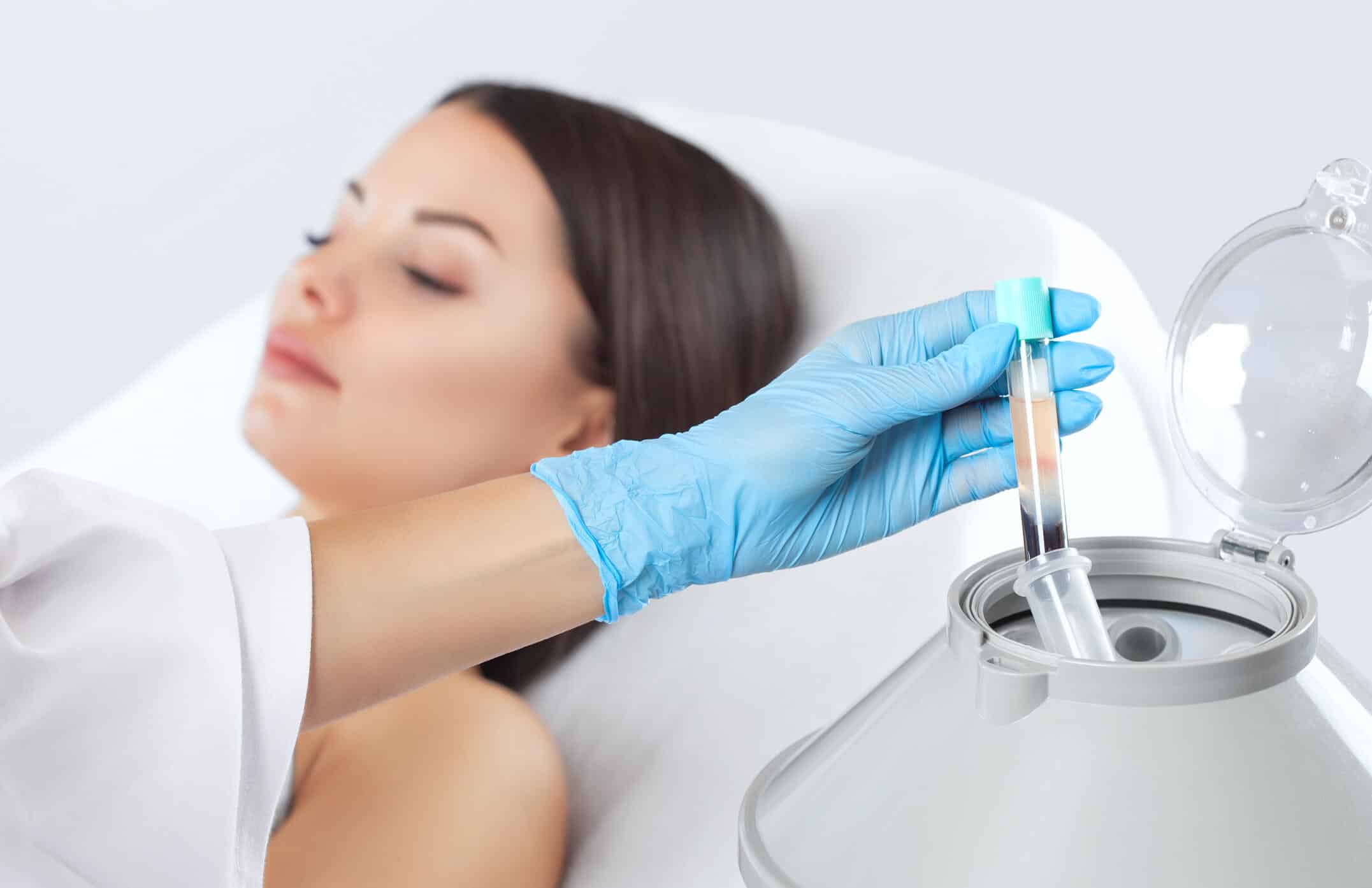 PRP treatment in Izmir for skin rejuvenation and hair restoration performed by a dermatologist